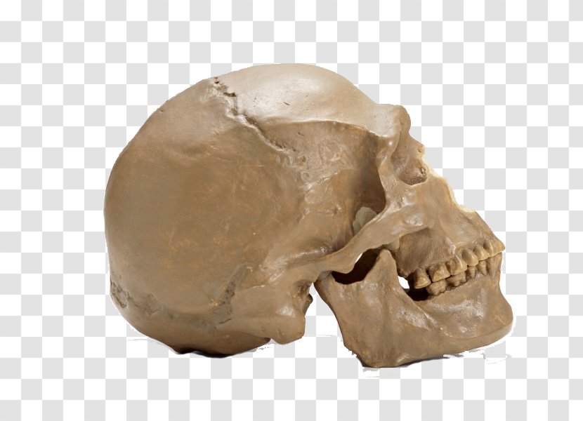 Skull Skeleton Bone - Dental Braces - Dark Transparent PNG