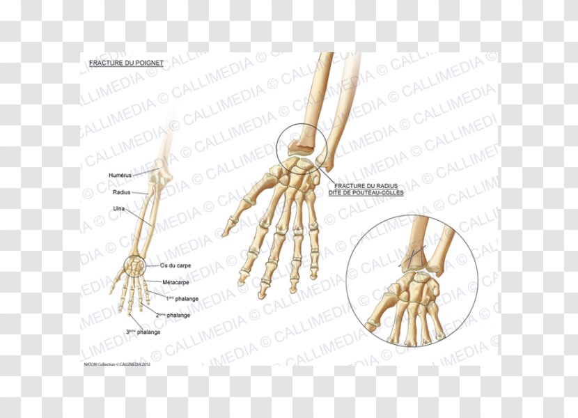 Bone Fracture Carpal Bones Wrist Pisiform - Watercolor - Skeleton Transparent PNG