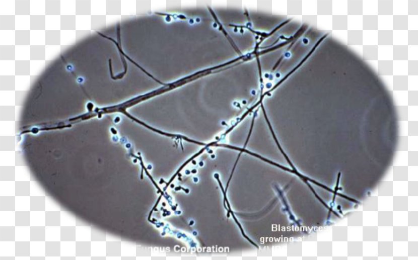Blastomyces Dermatitidis Fungus Blastomycosis White Piedra Microscopy - Microscope Transparent PNG