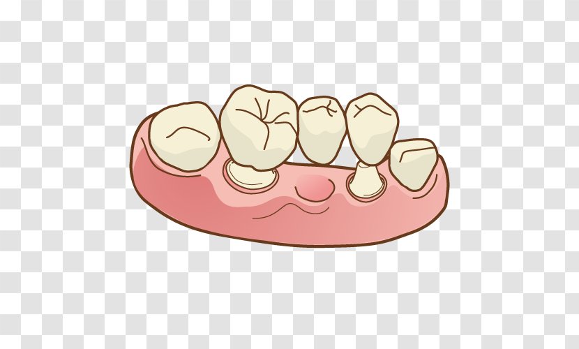 Dentist Dentures Therapy Dental Surgery 矯正歯科 - Smile - Bridge Transparent PNG