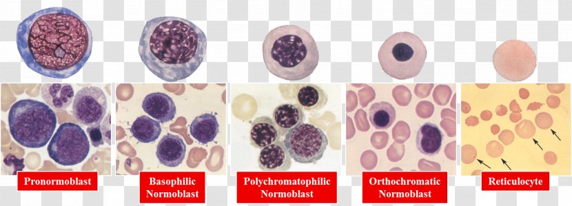 Erythropoiesis Red Blood Cell Hematology Neutrophil Haematopoiesis - Erythropoiesisstimulating Agent - Multiple Myeloma Transparent PNG