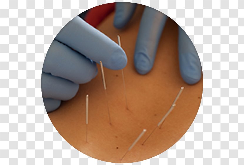 Physical Therapy Manual Acupuncture Clinic - Meaning - Needle Transparent PNG