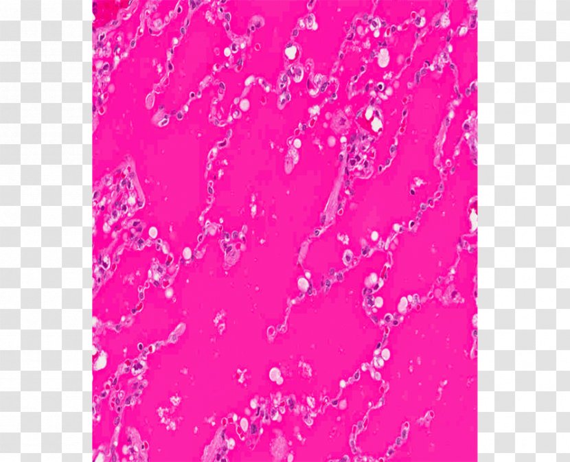 Pink M RTV Wallpaper - Magenta - Coalworker's Pneumoconiosis Transparent PNG