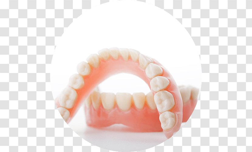 Dentistry Dentures Southwood Dental Studio Tooth - Bridge Transparent PNG
