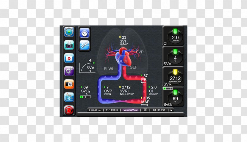 Display Device Cardiac Output Stroke Volume - Physiology Transparent PNG