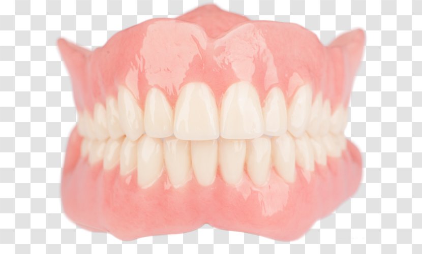 Tooth Dentures Dentistry Dental Laboratory - Restoration - Bridge Transparent PNG