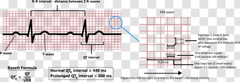 QT Interval Diagram Point Health Care Angle - Qt Transparent PNG