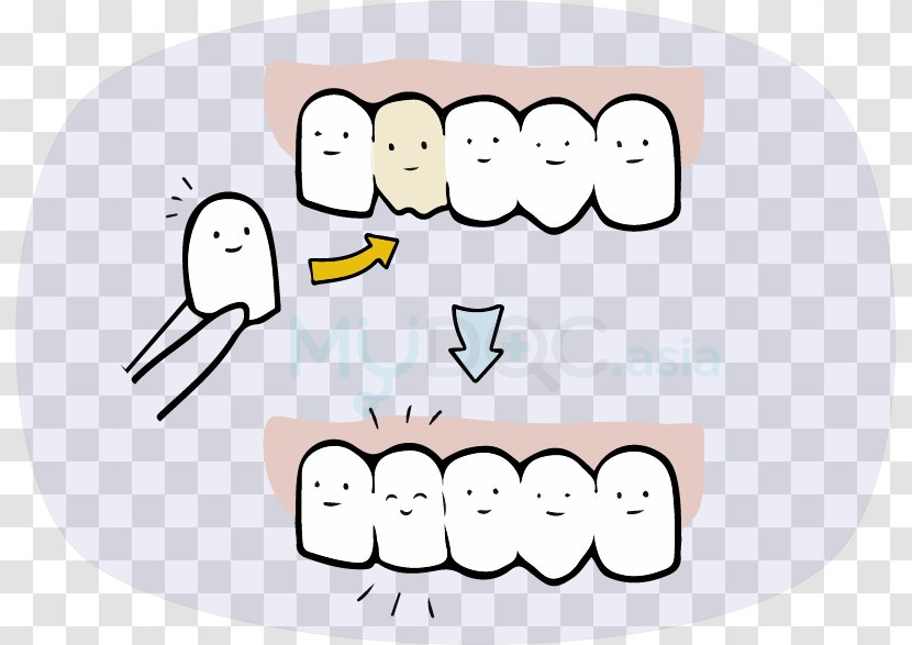 Clip Art Human Behavior Tooth Mouth Jaw - Tree - Coffee Stains Teeth Transparent PNG