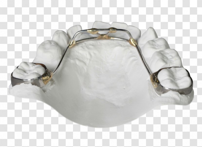 Gergen's Orthodontic Lab Orthodontics Tongue Sagittal Plane Retainer - Ring Transparent PNG