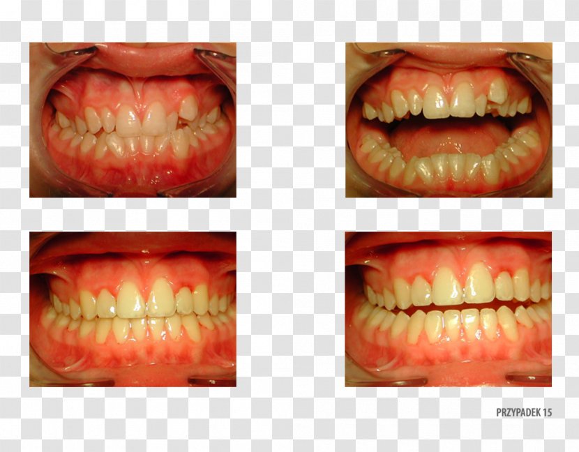 Orange Polska Close-up Therapy Patient - Smile Transparent PNG