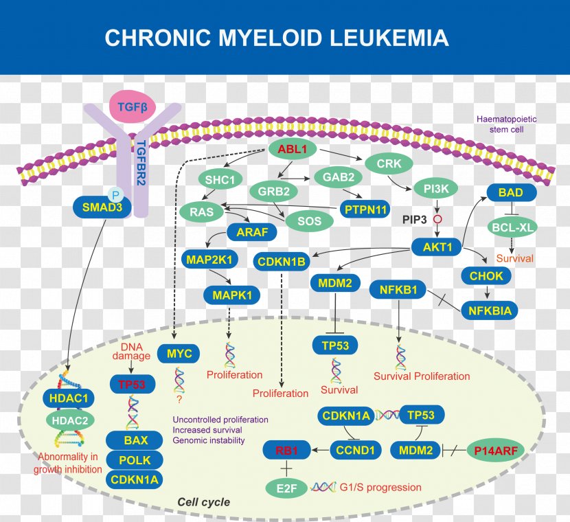 Chronic Myelogenous Leukemia ABL Acute Lymphoblastic Cancer Transparent PNG