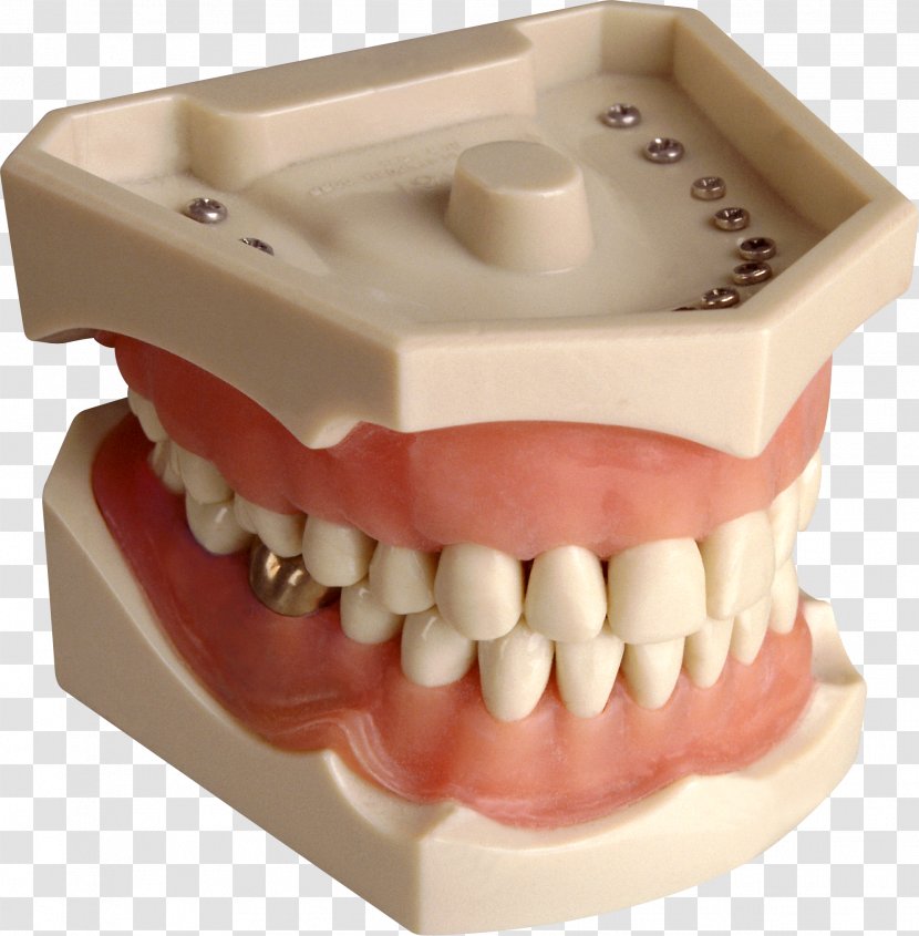 Jaw Mandible Maxilla Tooth Gums - Dentist - Steel Teeth Transparent PNG