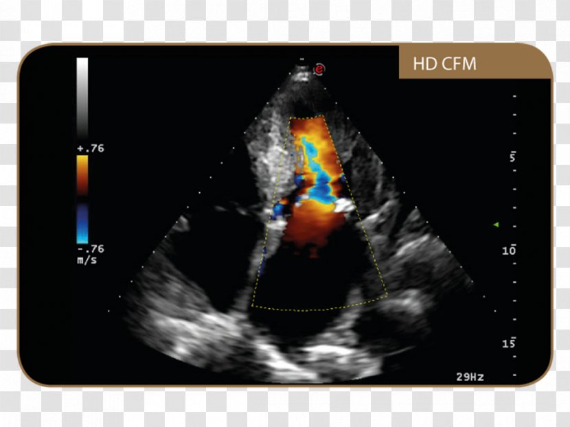 Ultrasonography Esaote Medical Equipment Magnetic Resonance Imaging Diagnosis - System - Twice Transparent PNG