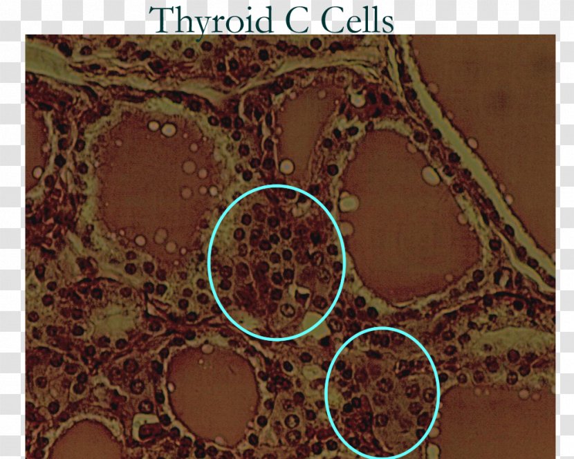 Parafollicular Cell Thyroid Endocrine System - Brown Transparent PNG