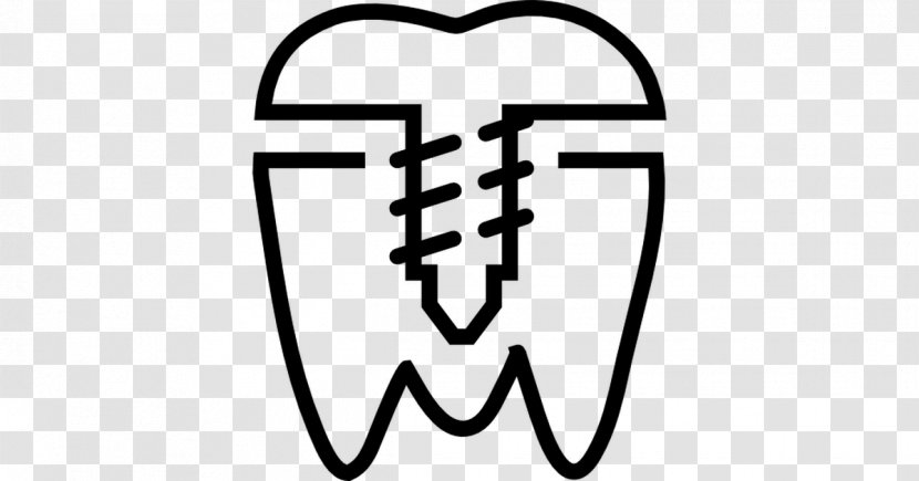 Dentistry Dental Implant Dentures All-on-4 - Silhouette - Health Transparent PNG