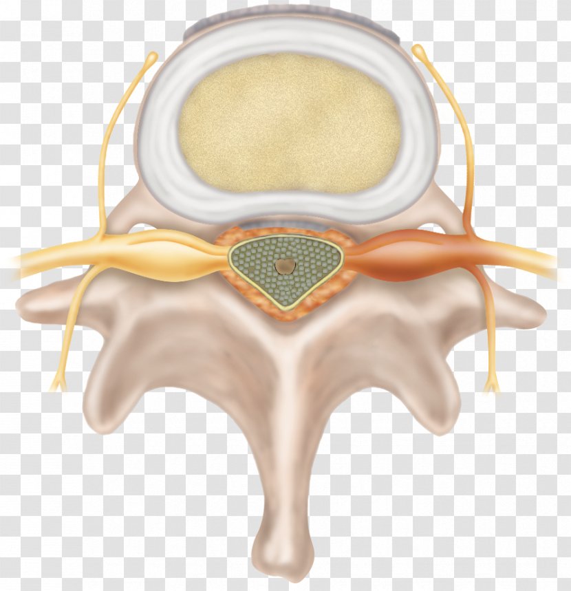 Spinal Disc Herniation Intervertebral Cervical Vertebrae Degenerative Disease Fusion - Cord Transparent PNG