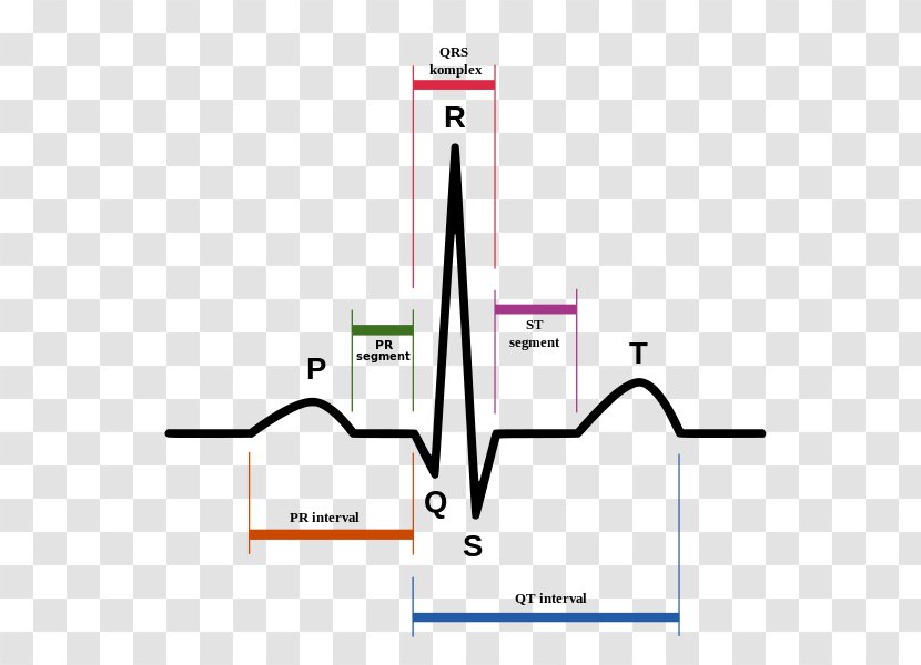 Sinus Rhythm Electrocardiography Heart Tachycardia Atrium - Qt Interval Transparent PNG