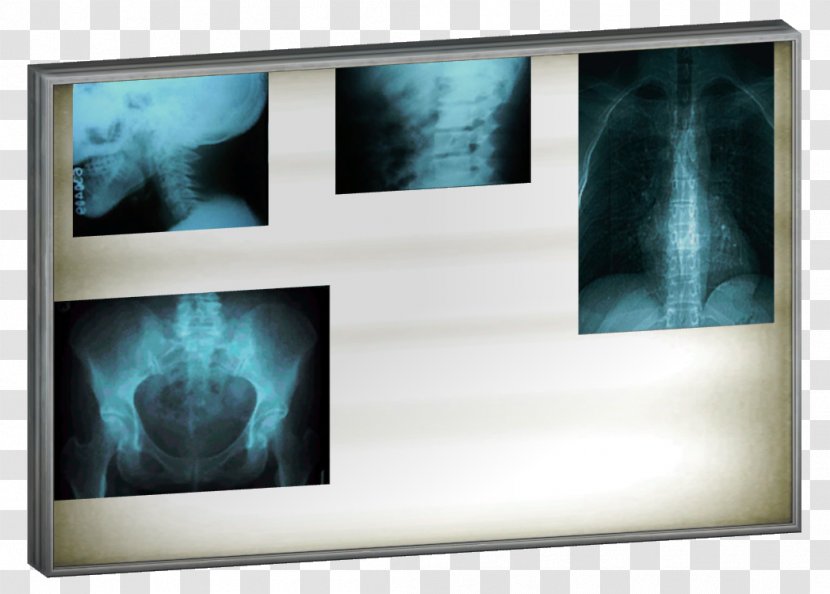 The Sims 4 Lightbox X-ray - Picture Frames - Light Transparent PNG