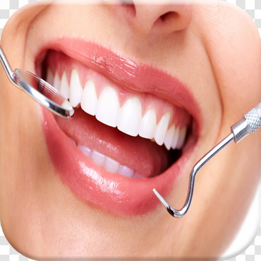 Tooth Dentistry Dental Extraction Surgery - Cosmetic - Smile Transparent PNG