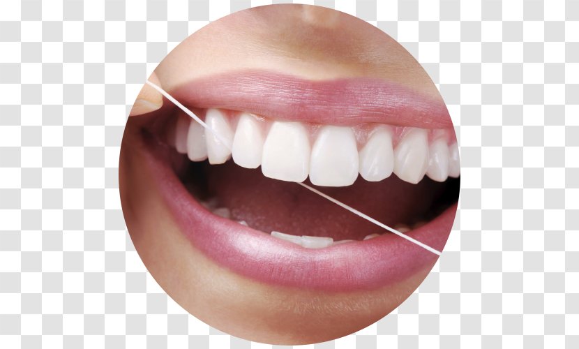 Dental Floss Periodontal Disease Dentistry Human Tooth - Gingivitis Transparent PNG