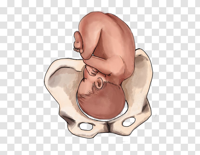 Childbirth Fetal Position Infant Breech Birth - Cartoon - Pregnancy Transparent PNG