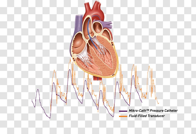 Cardiac Catheterization Heart Ailment Cath Lab Transparent PNG