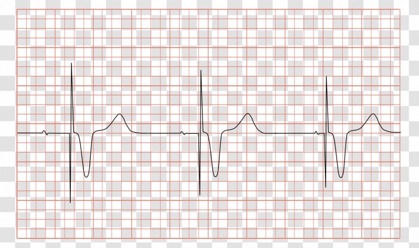 O’Reilly Media, Inc. Chief Executive Organization Apache Hadoop Computer Security Incident Management - Heart - Ecg Images Transparent PNG