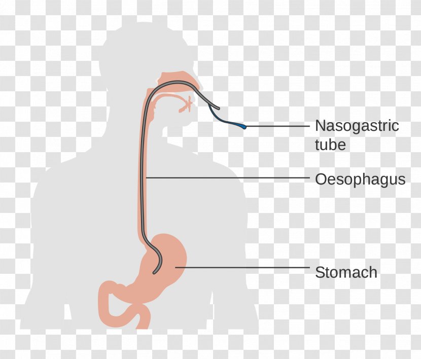 Esophagus Esophageal Cancer Human Anatomy Dysphagia Esophagectomy - Cartoon - The Correct Posture Of Baby Feeding Transparent PNG