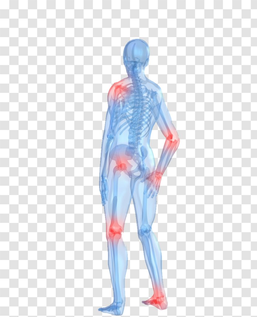 Arthritis Pain Human Body Rheumatoid Joint - Cartoon Transparent PNG