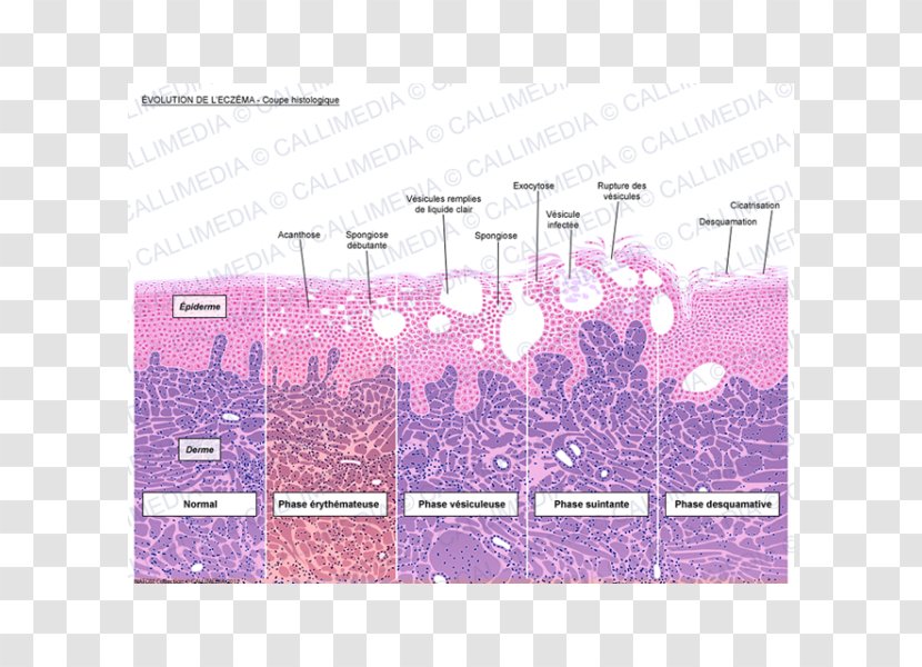 Introduction To Histology Dermatitis Keratinocyte Corte Histológico - Magenta - Eczema Transparent PNG