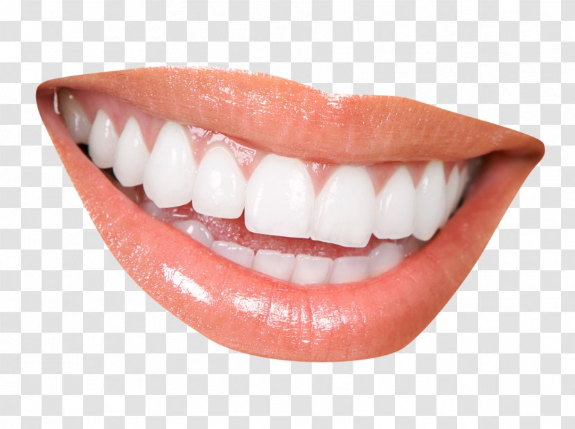 Cosmetic Dentistry Clinic Periodontology - Tongue - Teeth Transparent PNG