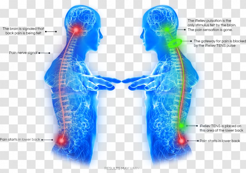 Low Back Pain Transcutaneous Electrical Nerve Stimulation Management Chronic - Frame Transparent PNG