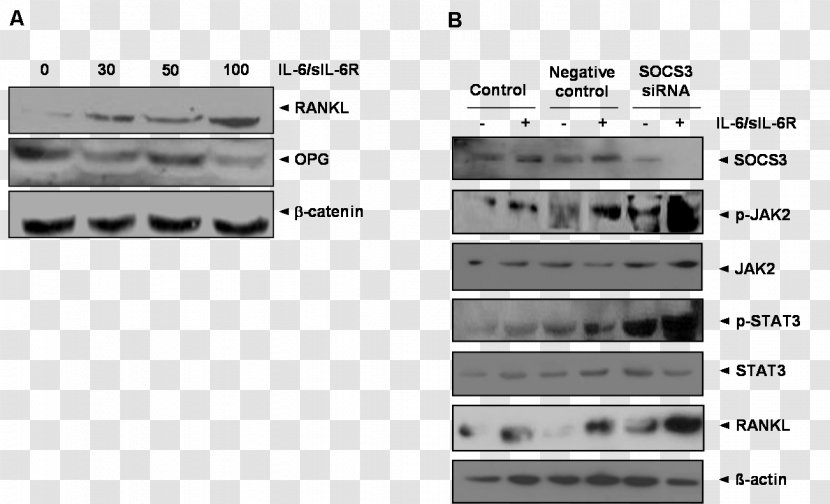 SOCS3 Interleukin 6 Janus Kinase 2 STAT3 RANKL - Silhouette - Tree Transparent PNG