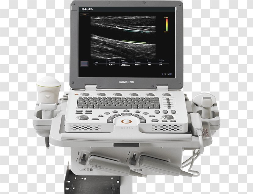 Medical Equipment Ultrasound Medicine Ultrasonography Ecógrafo Transparent PNG