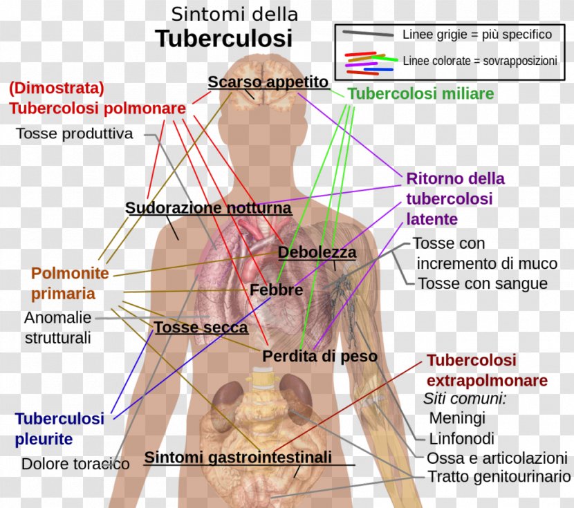 Tuberculosis Symptom Infection Infectious Disease - Silhouette - Health Transparent PNG