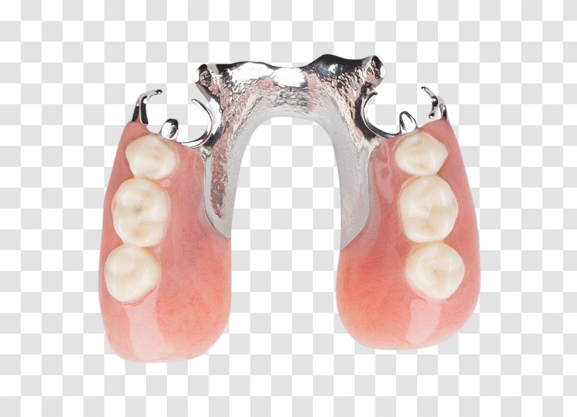 Human Tooth Dentures Removable Partial Denture Dentistry - Wiki - Aspen Dental Transparent PNG