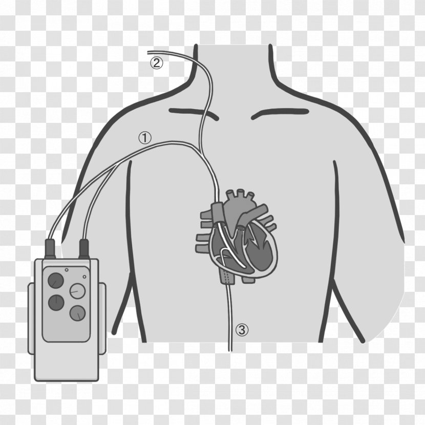 Artificial Cardiac Pacemaker Nursing Medical Device Illustration Automated External Defibrillators - Flower - Extra Corporeal Septoplasty Transparent PNG