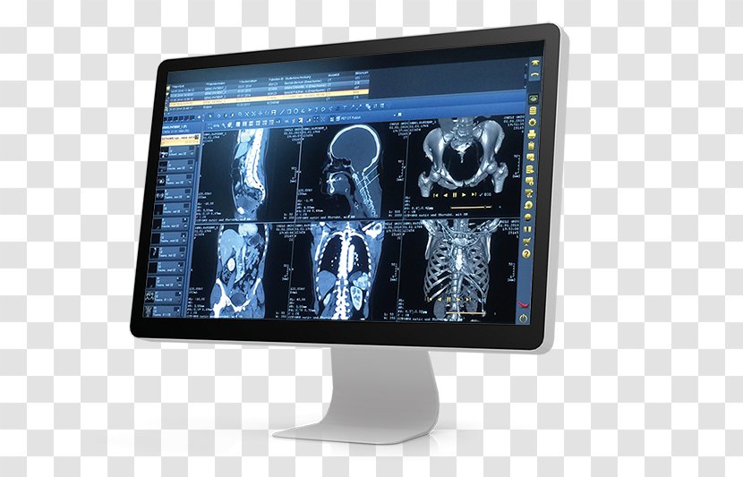 Picture Archiving And Communication System DICOM Medical Imaging Physician Hospital - Electronics - Splat Transparent PNG