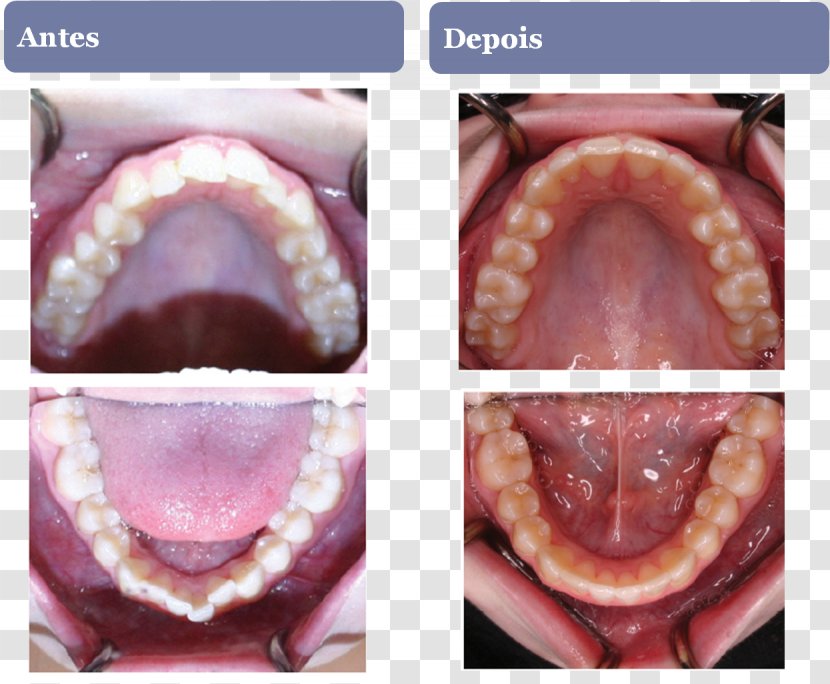 Close-up Lip - Flower - Dentista Transparent PNG