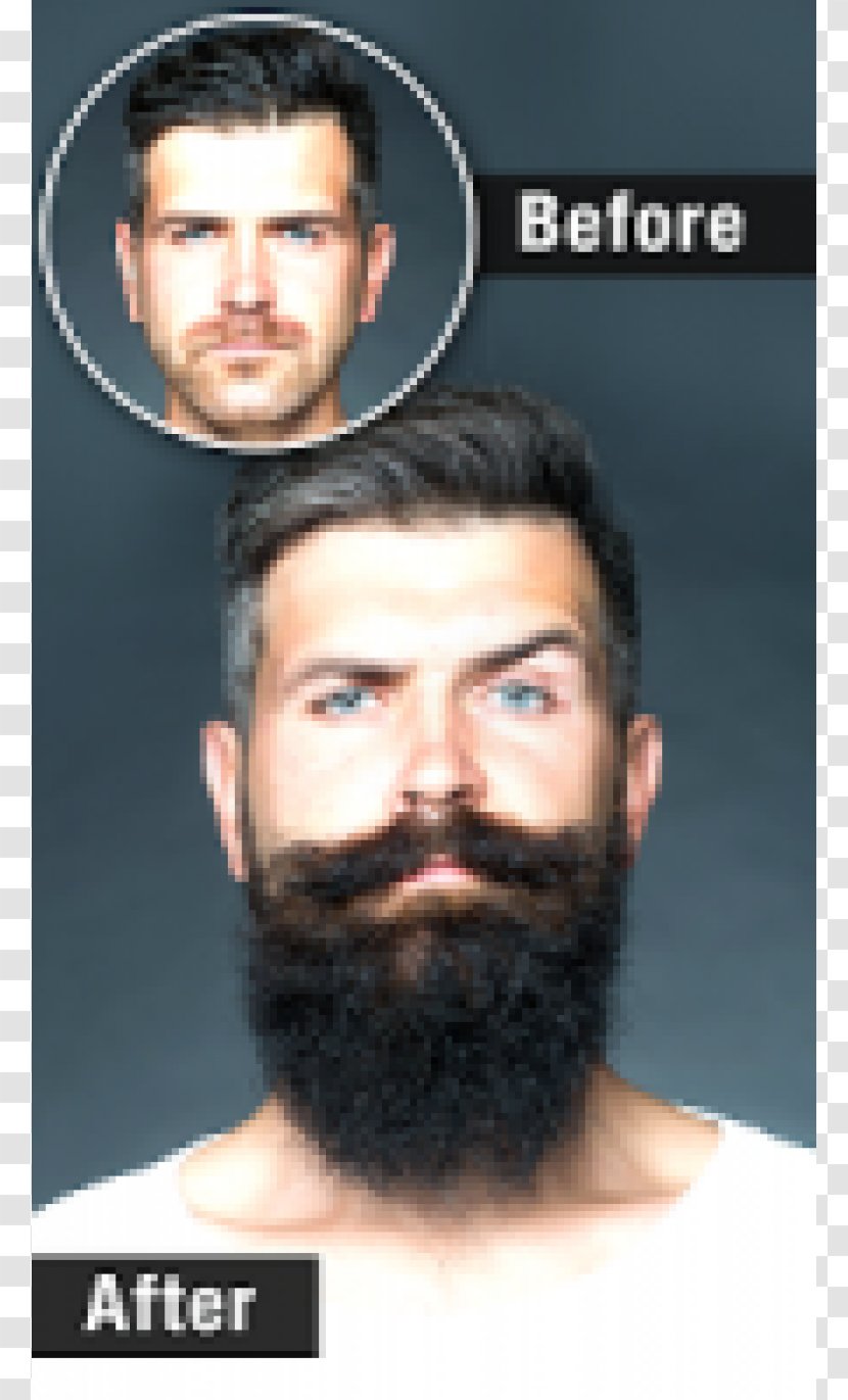 Beard Facial Hair Shaving Hairstyle - Removal - And Moustache Transparent PNG