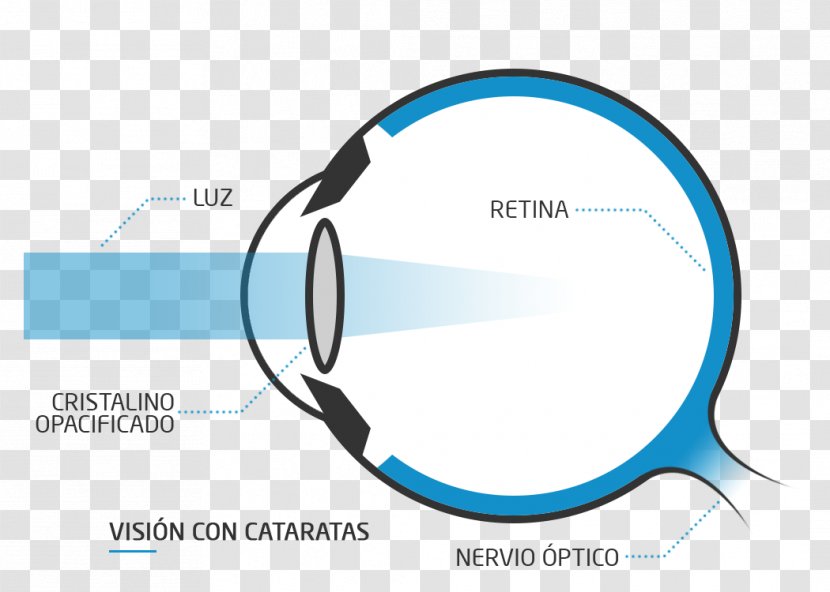 Floater Presbyopia Eye Far-sightedness Near-sightedness - Farsightedness Transparent PNG