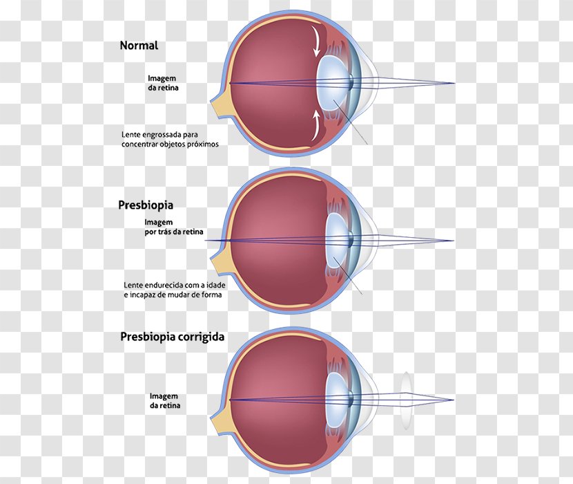 Presbyopia Progressive Lens Ophthalmology Near-sightedness - Diagram - CLINICA Transparent PNG