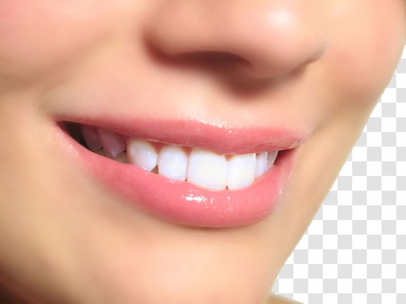 Tooth Whitening Dentistry Pathology - Cartoon - Teeth Model Transparent PNG