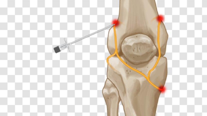 Hip Knee Genicular Artery Nerve Joint - Cartoon - Pain Transparent PNG