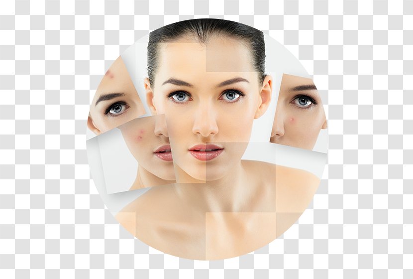 Personal Care Acne Facial Exfoliation Skin - Scar - Face Transparent PNG