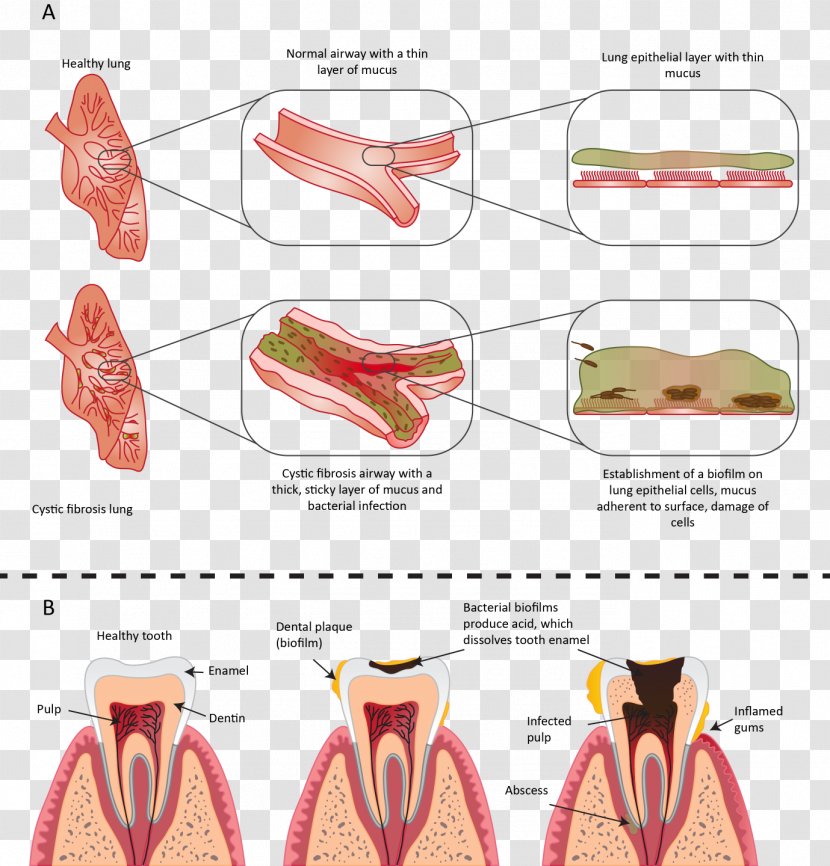 Microorganism Biofilm Bacteria Pathogenesis - Heart - Bacterıa Teeth Transparent PNG