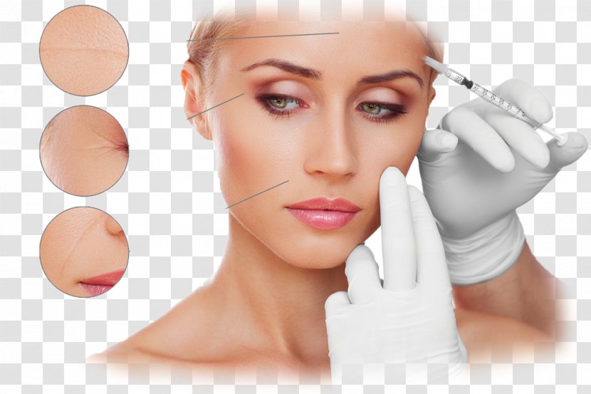 Plastic Surgery Wrinkle Botulinum Toxin RG Pro Laser - Chin - Skin Care Transparent PNG