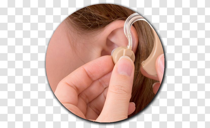 Hearing Aid Loss Otorhinolaryngology - Cochlear Implant - Ear Transparent PNG