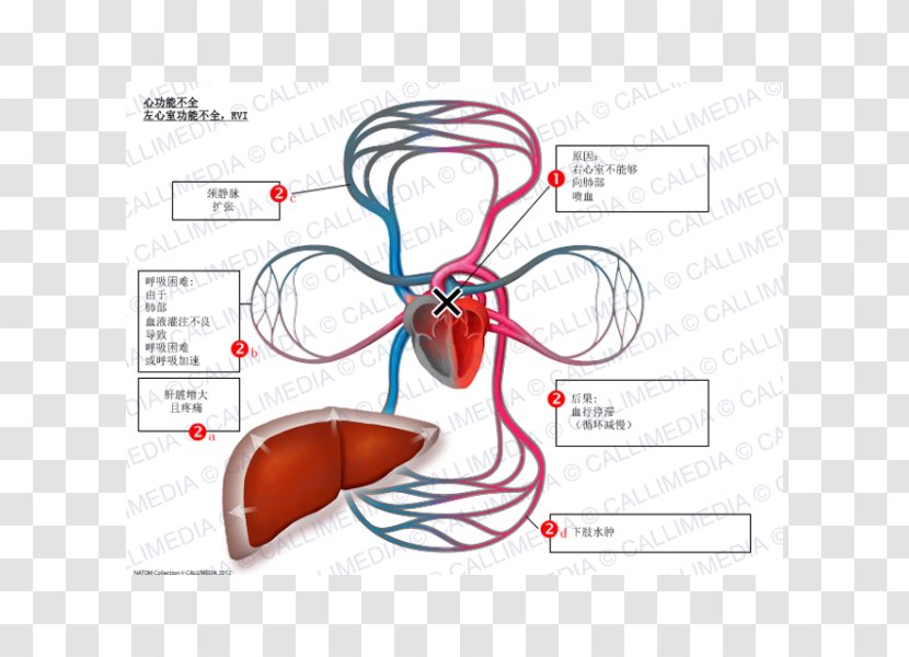 Heart Ailment Ventricle Cardiology Rate Symptom - Tree - Digestif Transparent PNG