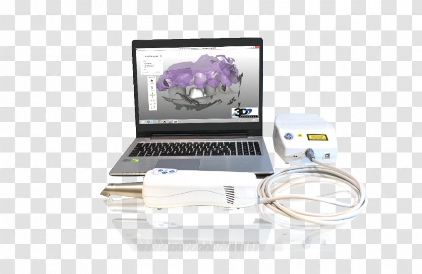 Nika Treyd Image Scanner CAD/CAM Dentistry Digital Data - Tooth - 3d Dental Treatment For Toothache Transparent PNG